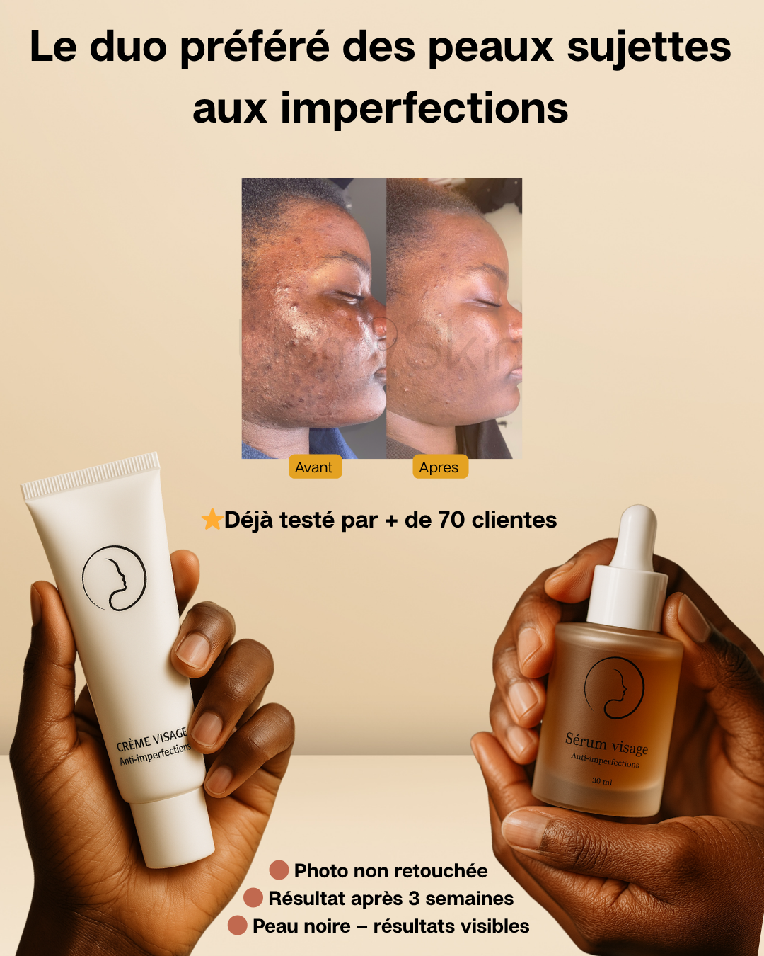 Pack duo Acné & imperfections